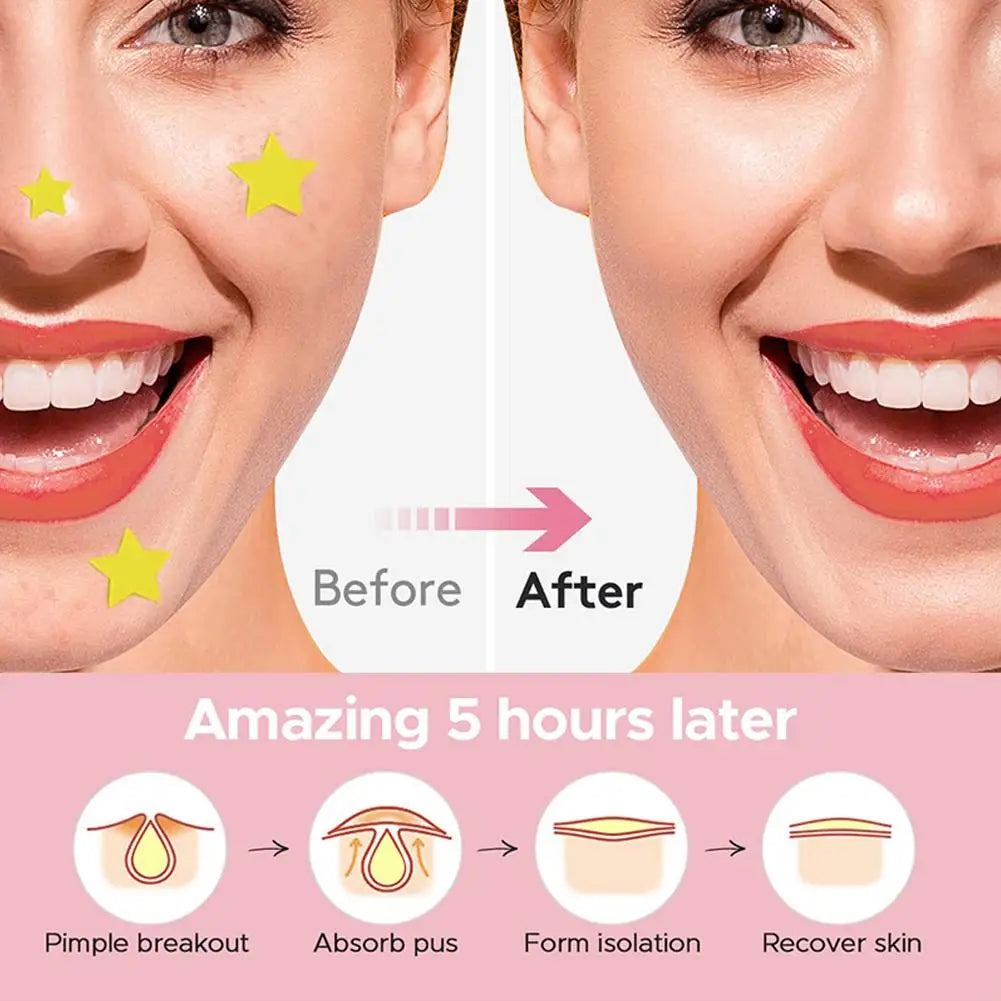 Overnight Acne Healing Patch